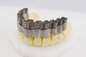 Ενιαίος ινών εκτυπωτής μετάλλων λέιζερ τρισδιάστατος για την οδοντική βιομηχανία κοσμήματος